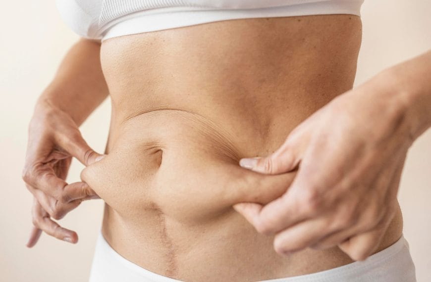 Close-up of excess abdominal skin after weight loss.